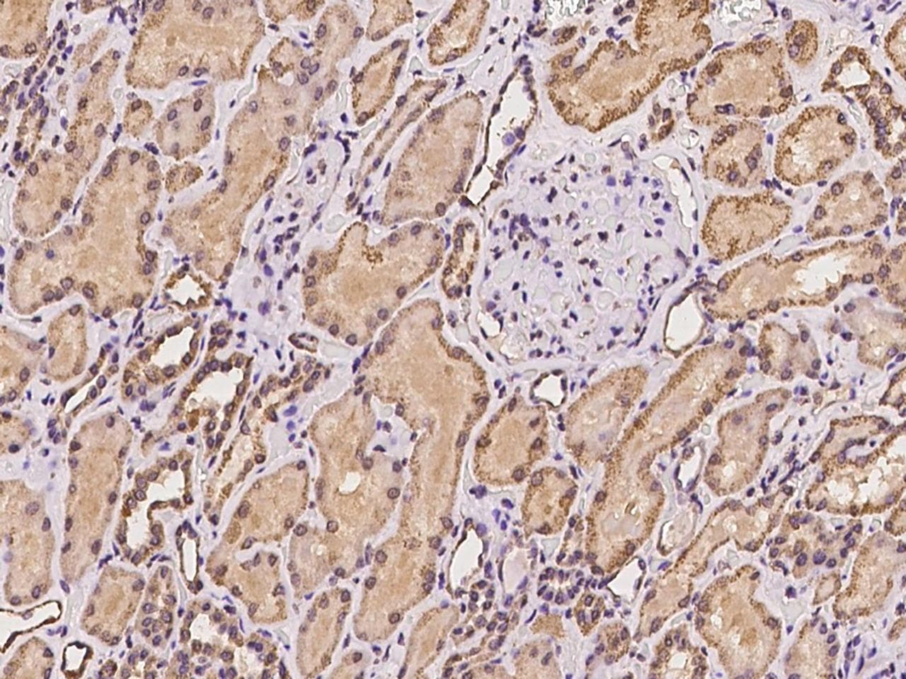 Polyclonal Rabbit anti-Human TYRO3 Antibody (IHC)