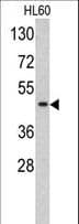 Polyclonal Rabbit anti-Human TBP / GTF2D Antibody (aa301-330, IHC, IF, WB)