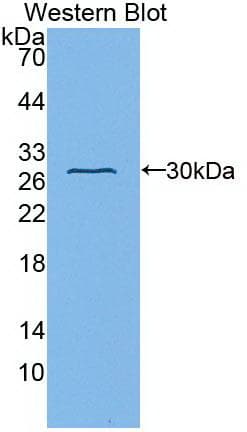 FBLN1 / Fibulin 1 Antibody (clone C6)
