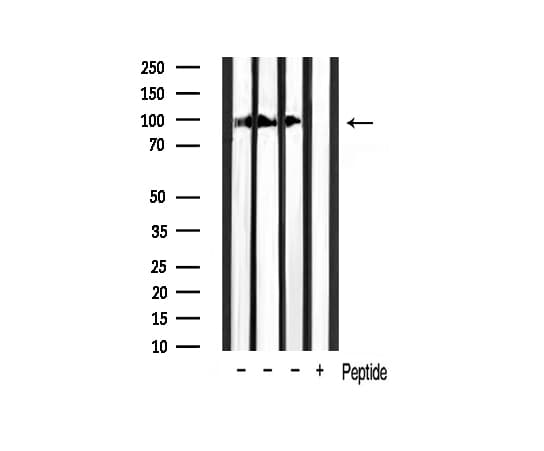 CTNNB1 / Beta Catenin Antibody (phospho-Ser37)