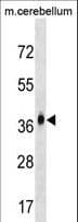 MMD2 Antibody (aa6-35)