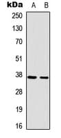 RAD51 / RECA Antibody (C-Terminus)