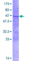 Human TLX2 / NCX Protein (Recombinant GST)