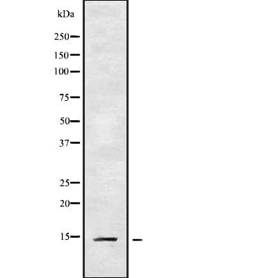 Polyclonal Rabbit anti-Human VCC-1 / CXCL17 Antibody (WB)