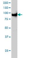 UHRF1 Antibody (clone 3A11)