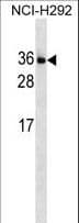 IL34 Antibody (aa27-53)