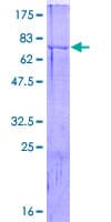 Human CDC20 Protein (Recombinant GST)
