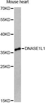Polyclonal Rabbit anti-Human DNASE1L1 Antibody (WB)