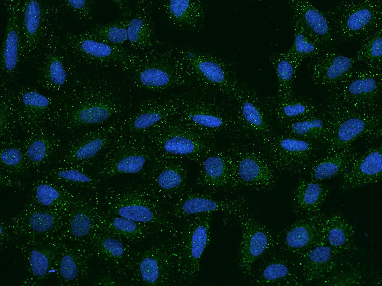 SEMA3A / Semaphorin 3A Antibody