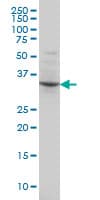 Monoclonal Mouse anti-Human POU4F3 / BRN3C Antibody (clone 5B8, IF, WB)