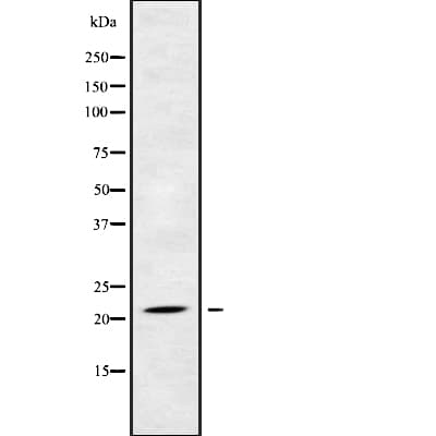 NDUFB5 Antibody