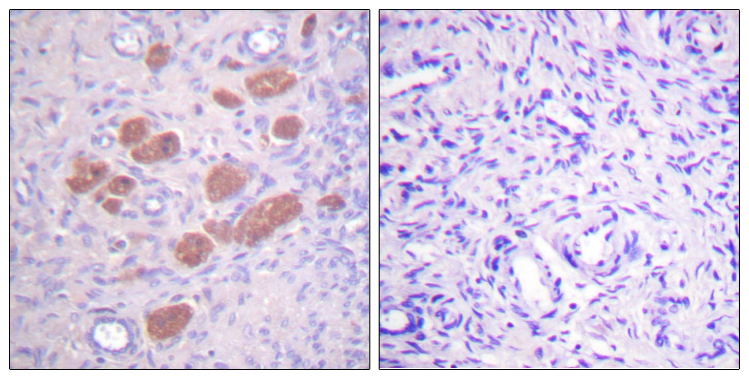 P40PHOX / NCF4 Antibody (phospho-Thr154)