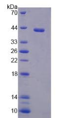 Human PTMA / Prothymosin Alpha Protein (Recombinant His-GST)
