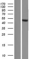 TRIM64B Protein (Over-Expression Lysate Myc-DDK (Flag))