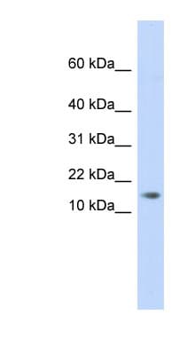 AAMDC Antibody (C-Terminus)