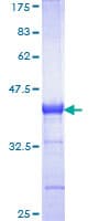 Human CBS Protein (Recombinant GST, N-terminus)