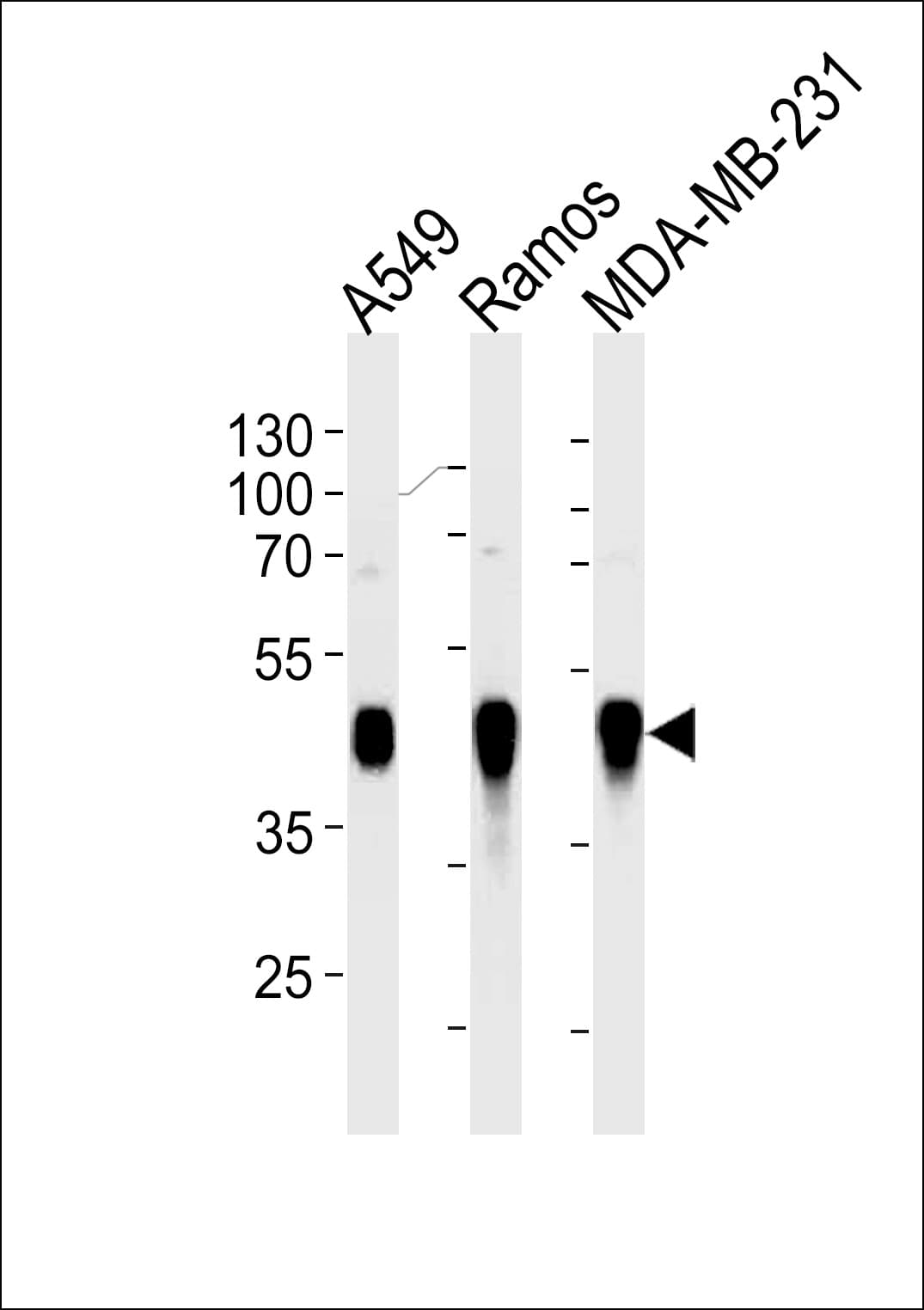 HLA-G Antibody (clone 800CT6.4.2)
