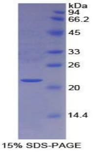 Rat PRDX6 / Peroxiredoxin 6 Protein (Recombinant His)