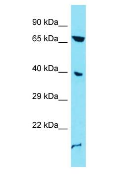 Polyclonal Rabbit anti-Human ENO4 Antibody (aa193-242, WB)