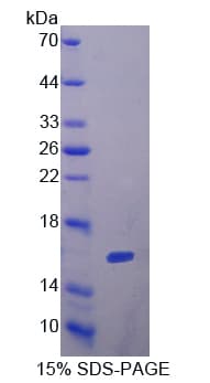 Rat FSHB / FSH Beta Protein (Recombinant His, N-Terminal)
