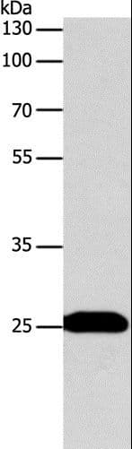 BCL2 / Bcl-2 Antibody