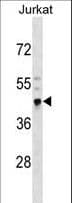 Polyclonal Rabbit anti-Human CRELD2 Antibody (aa23-51, WB)