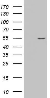 AMACR / P504S Antibody (clone OTI5G8)