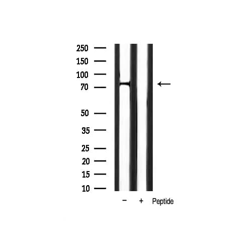 FOXO1 / FKHR Antibody (phospho-Ser319)