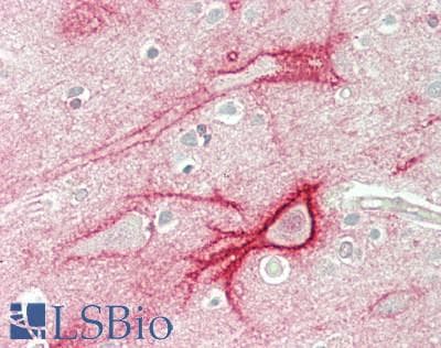 IHC-plus™ HIP1 Antibody