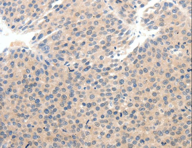 IHC-plus™ Polyclonal Rabbit anti-Human SCN10A / Nav1.8 Antibody (aa31-45, IHC)