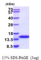Mouse FKBP1A / FKBP12 Protein (Recombinant His)