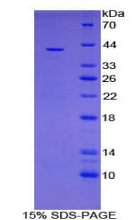 Human VTCN1 / B7-H4 Protein (Recombinant His-GST)