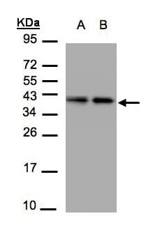 Polyclonal Rabbit anti-Human TBCC Antibody (aa52-306, WB)