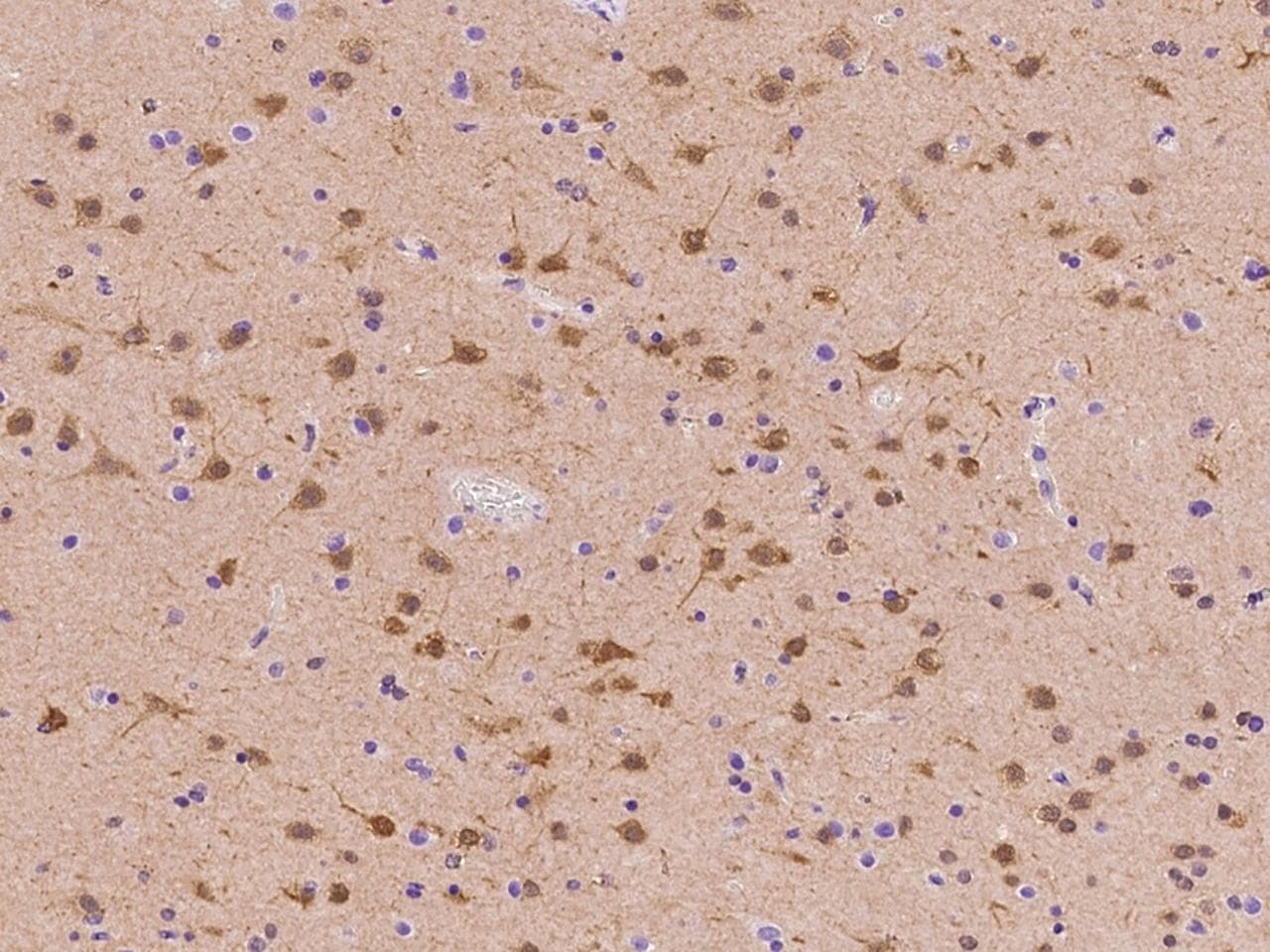 HOPX / HOP Antibody