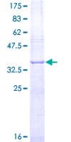 Human FGF2 / Basic FGF Protein (Recombinant GST, N-terminus)