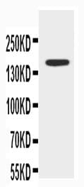Polyclonal Rabbit anti-Human ABCB4 / MDR3 Antibody (aa1-20, WB)