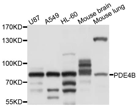 PDE4B Antibody