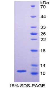 Human PKM / Pyruvate Kinase, Muscle Protein (Recombinant His)