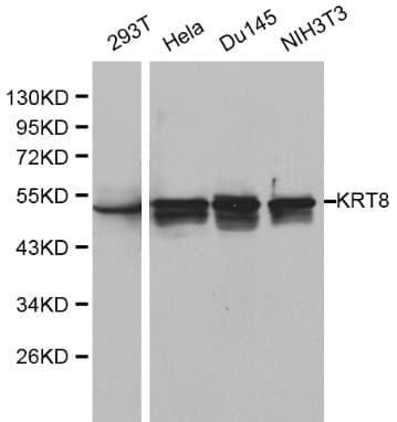 KRT8 / CK8 / Cytokeratin 8 Antibody