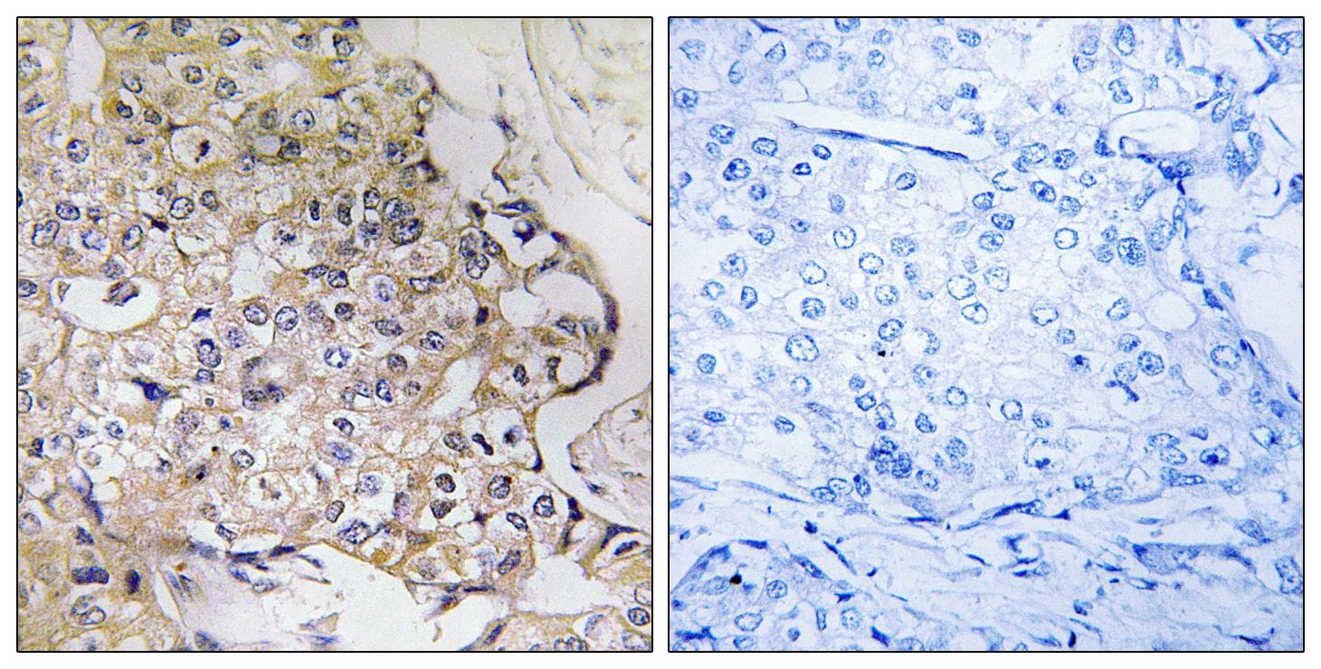 Polyclonal Rabbit anti-Human PART1 Antibody (IHC)