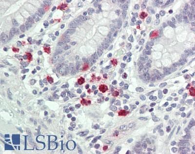 IHC-plus™ MAP3K7 / TAK1 Antibody (aa411-460)