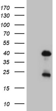 OTX2 Antibody (clone OTI1B2)