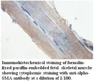 ACTA2 / Smooth Muscle Actin Antibody (aa31-307)