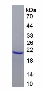 Rat EPOR / EPO Receptor Protein (Recombinant His)