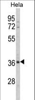 MDFIC / HIC Antibody (aa73-99)