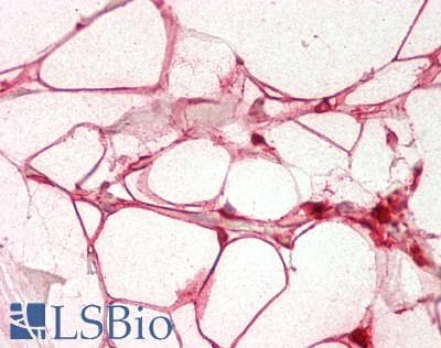 IHC-plus™ LGALS3 / Galectin 3 Antibody