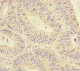 Polyclonal Rabbit anti-Human MTHFD2 Antibody (IHC, WB)