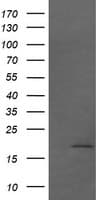 CTAG1B / NY-ESO-1 Antibody (clone OTI2G2, Carrier-free)