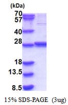Human CPTP / GLTPD1 Protein (Recombinant His)