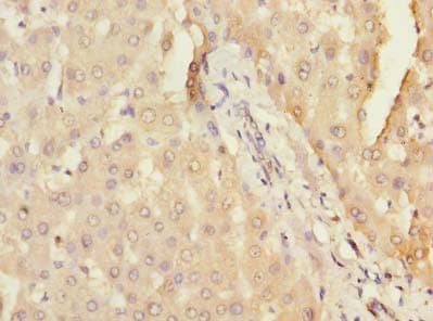 Polyclonal Rabbit anti-Human DHX30 Antibody (IHC)